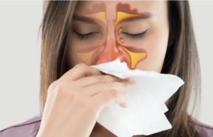 மூக்கு ஒழுகுதல்: மூக்கடைப்பை நீக்கி நிம்மதியாக சுவாசிப்பது உறுதி!