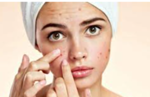 பருக்கள் உங்களைத் தொந்தரவு செய்கிறதா? இதைச் செய்தால், உங்கள் முகம் பளபளப்பாக இருக்கும்.