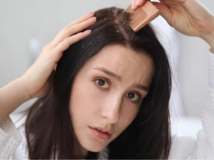 பெண்களுக்கு பொடுகு பிரச்சனையை தீர்க்க உதவும் குறிப்புகள்.