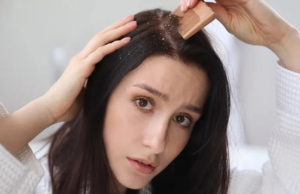 பெண்களுக்கு பொடுகு பிரச்சனையை தீர்க்க உதவும் குறிப்புகள்.