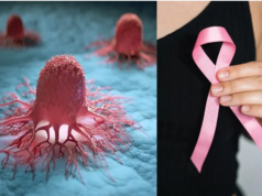 புற்றுநோய் உண்மையில் ஏன் ஏற்படுகிறது? அதைத் தடுக்க முடியாதா?