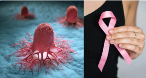 புற்றுநோய் உண்மையில் ஏன் ஏற்படுகிறது? அதைத் தடுக்க முடியாதா?