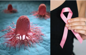 புற்றுநோய் உண்மையில் ஏன் ஏற்படுகிறது? அதைத் தடுக்க முடியாதா?