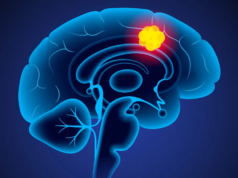 புற்றுநோய் சிகிச்சையில் புதிய புரட்சி: 5 நாட்களில் மூளைக் கட்டியை மறையச் செய்த புதிய மருந்து – விஞ்ஞானிகளின் அசத்தல் கண்டுபிடிப்பு! புற்றுநோய் செல்களை அழிக்கும் கார்ட்-டி செல் தெரபி (CAR-T Cell Therapy) மற்றும் மூளை ஸ்கேன் அறிக்கை