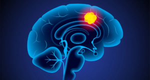 புற்றுநோய் சிகிச்சையில் புதிய புரட்சி: 5 நாட்களில் மூளைக் கட்டியை மறையச் செய்த புதிய மருந்து – விஞ்ஞானிகளின் அசத்தல் கண்டுபிடிப்பு! புற்றுநோய் செல்களை அழிக்கும் கார்ட்-டி செல் தெரபி (CAR-T Cell Therapy) மற்றும் மூளை ஸ்கேன் அறிக்கை